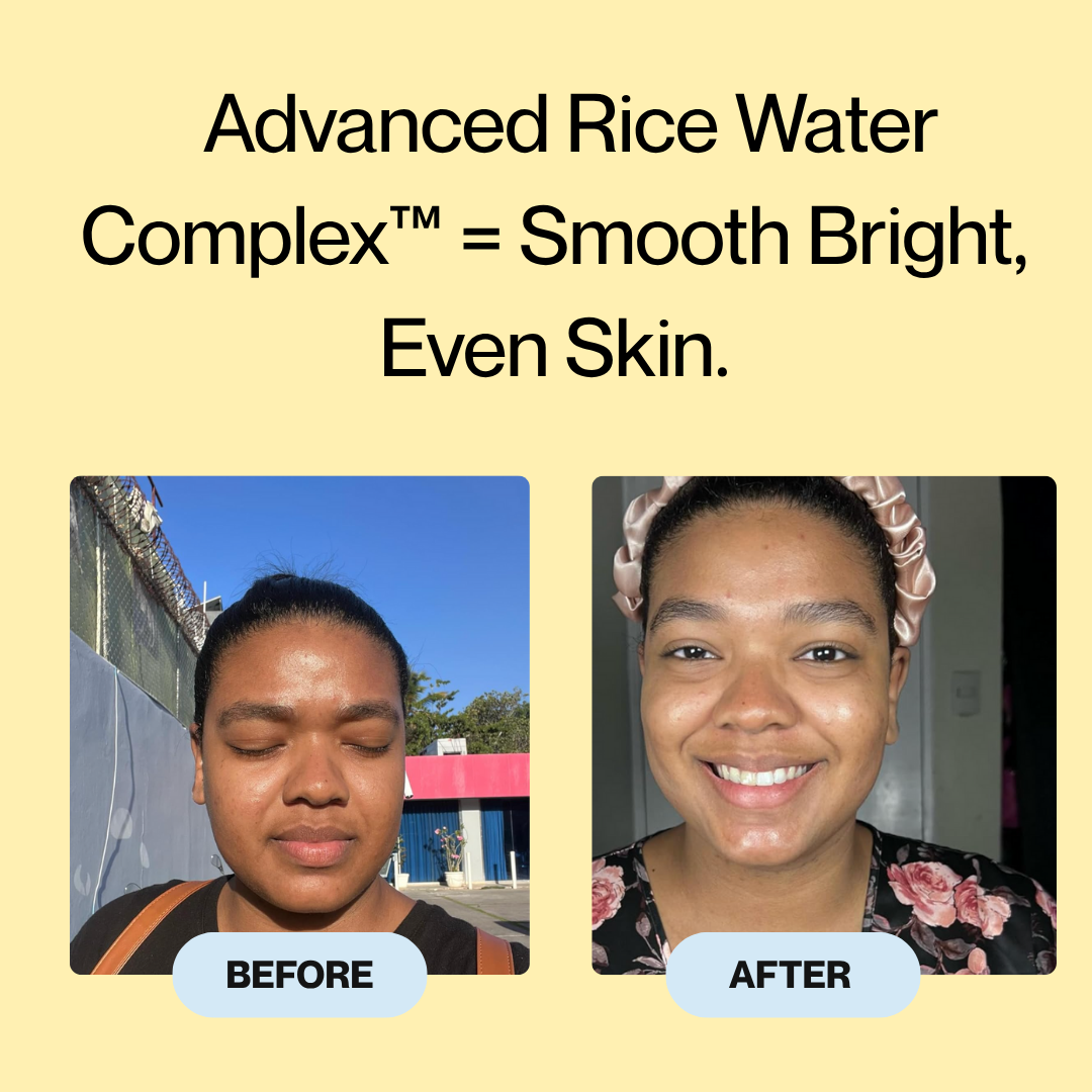 Oryza Rice Peel Ampoule