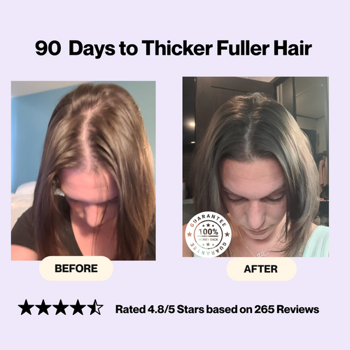 14-in-1 Hair + Skin + Nails Boost Complex