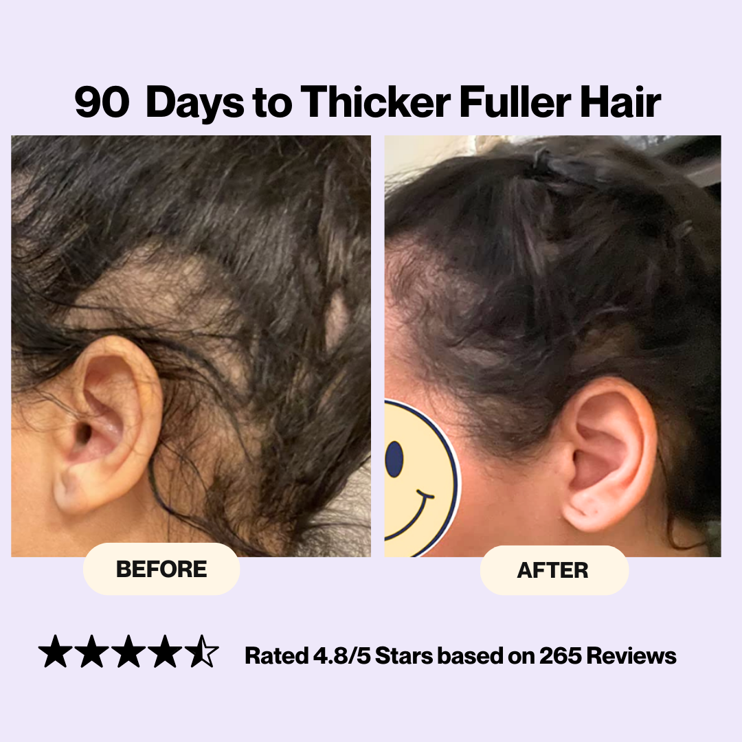 14-in-1 Hair + Skin + Nails Boost Complex