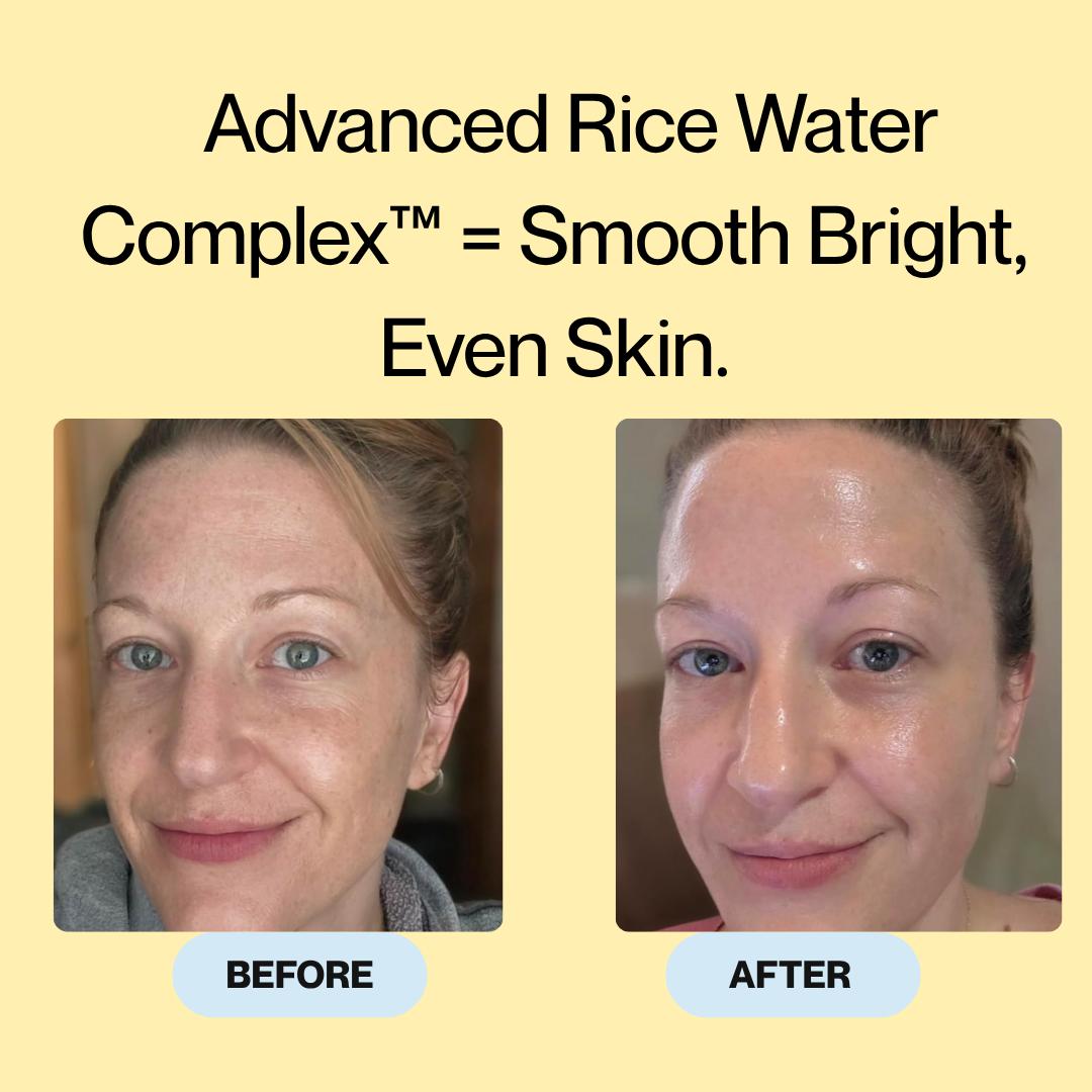 Oryza Rice Peel Ampoule